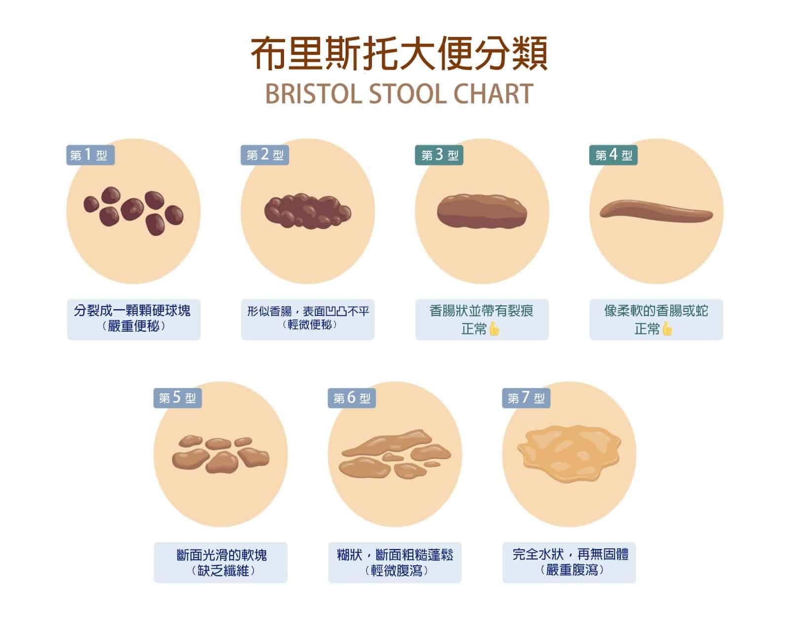 布里斯托大便分類表可以了解自己的腸道健康狀態。