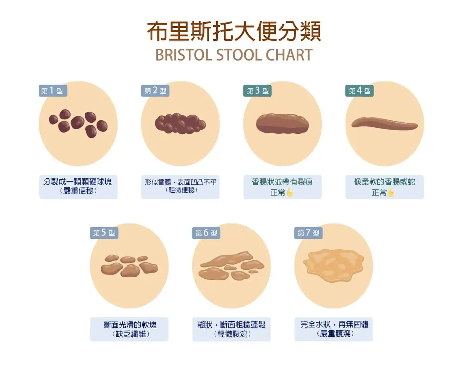 布里斯托大便分類表可以了解自己的腸道健康狀態。